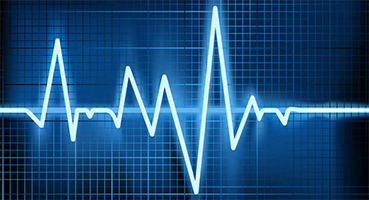 Electric heart beat 2