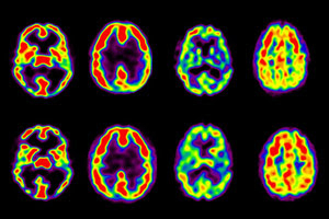 Your brain on drugs. Literally 2