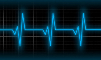 Electric heart beat
