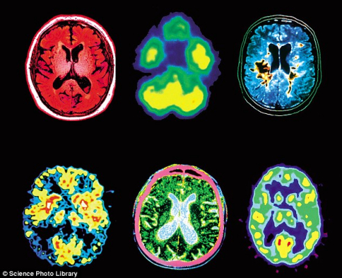 Your brain on drugs. Literally