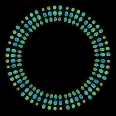 Your brain on drugs. Literally 3 round preview